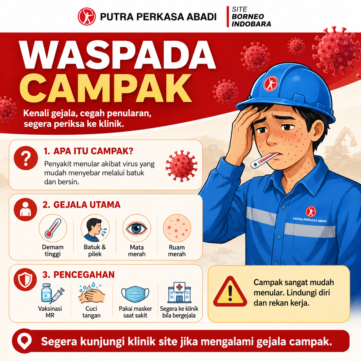 Waspada Campak