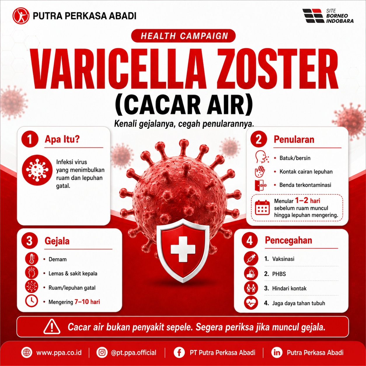 Varicella Zoster (CACAR AIR)